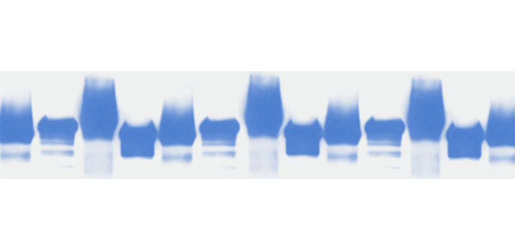 Western blot Protocol from Abcam!